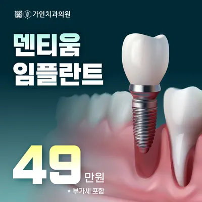 덴티움 임플란트 49만원 이벤트 썸네일 이미지