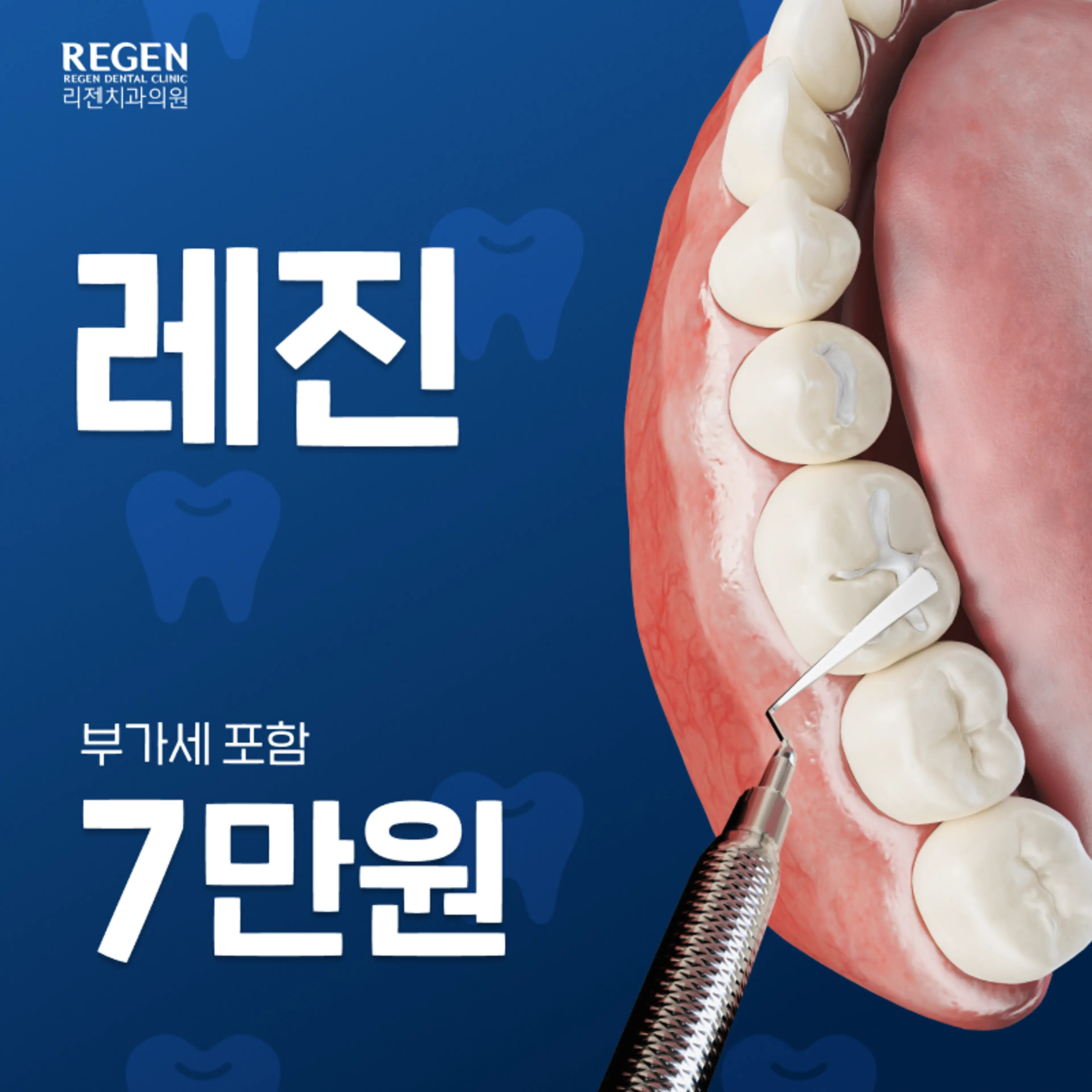 레진 7만원