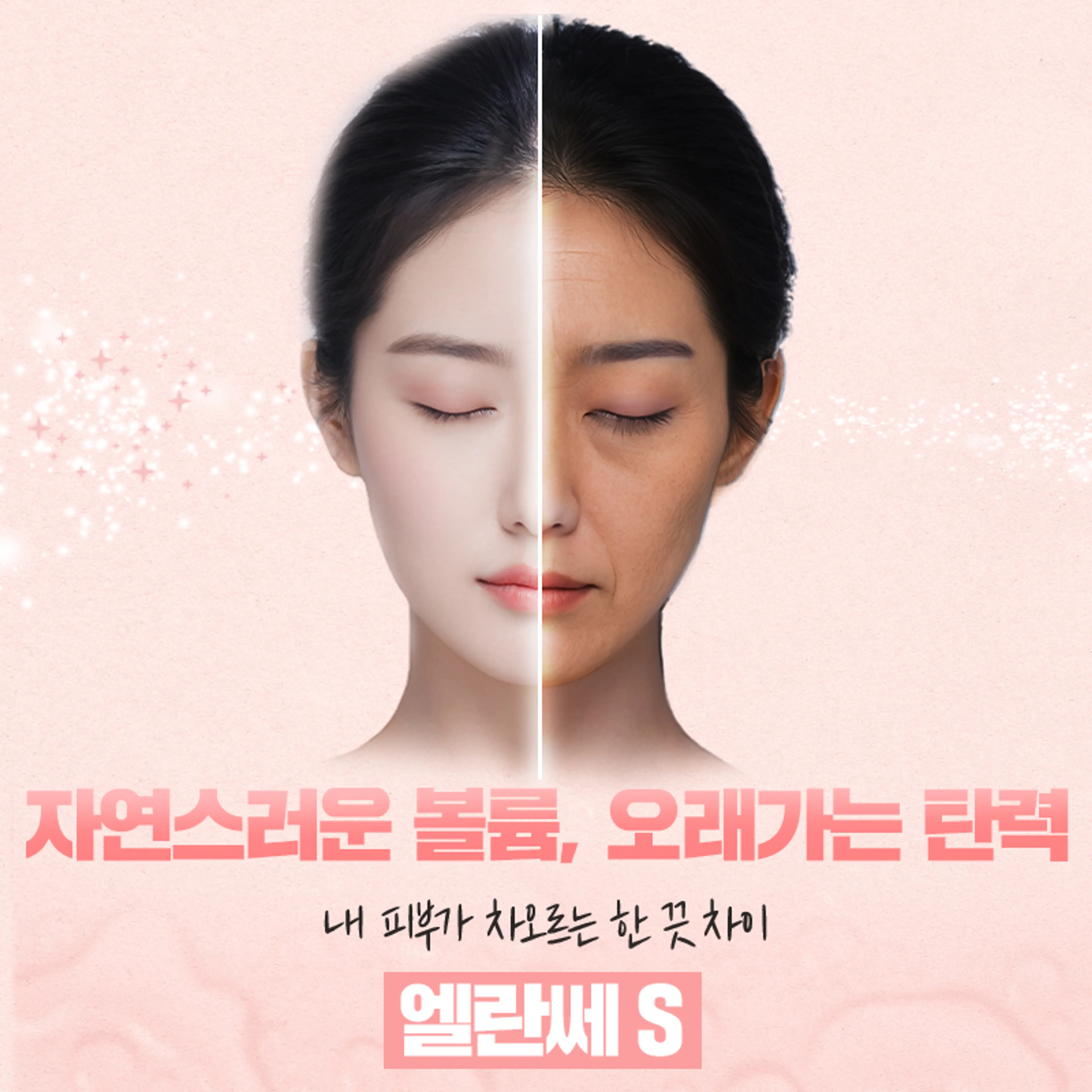 샤인유_엘란쎄S 1CC