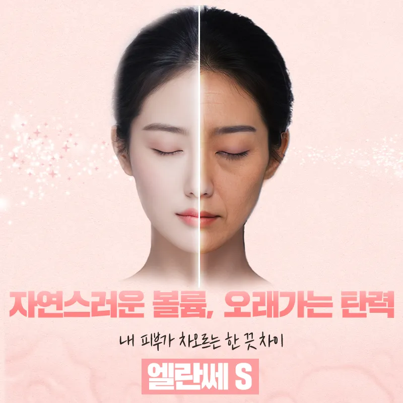 샤인유_엘란쎄S 3+1CC 이벤트 썸네일 이미지