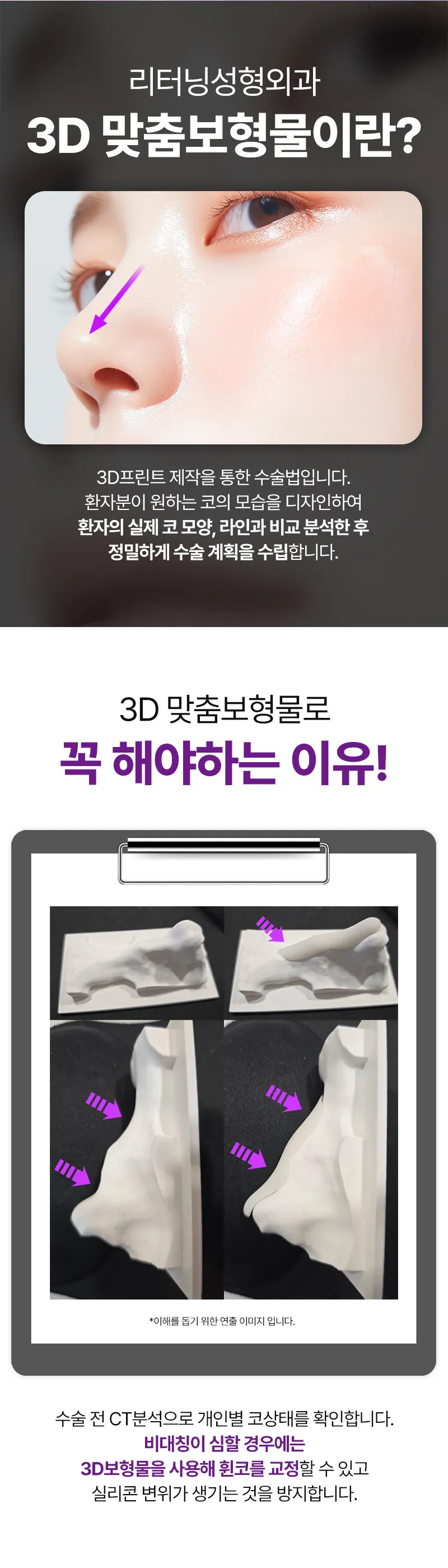 리터닝성형외과  리터닝3D핏미코맞춤보형물 이벤트, 시술 상세 이미지