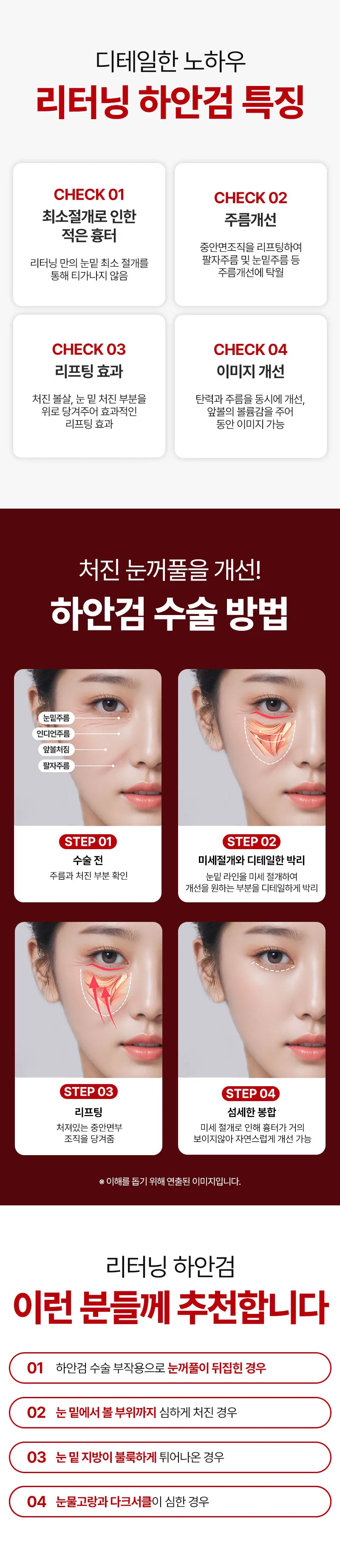 리터닝성형외과 리터닝 하안검 이벤트, 시술 상세 이미지