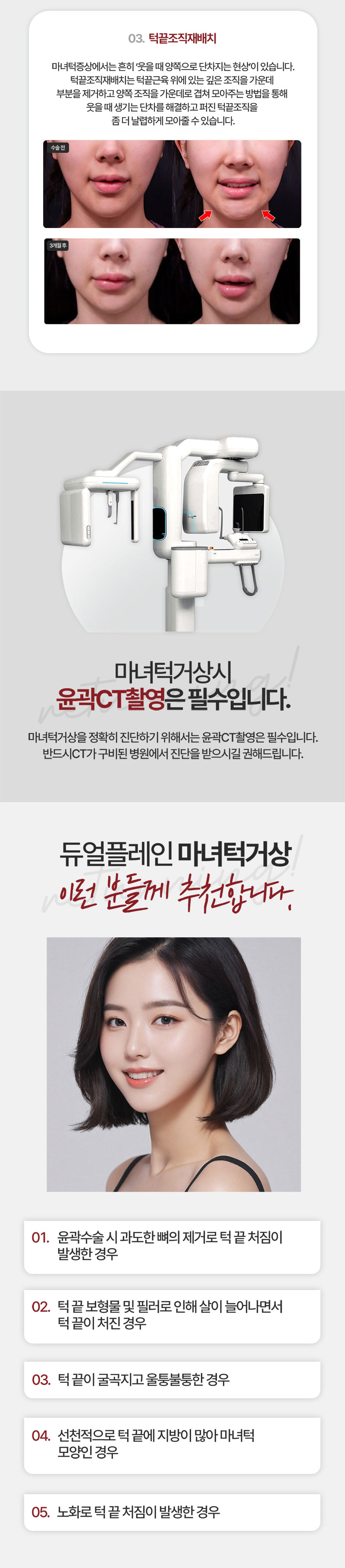 리터닝성형외과 리터닝 마녀턱거상 이벤트, 시술 상세 이미지