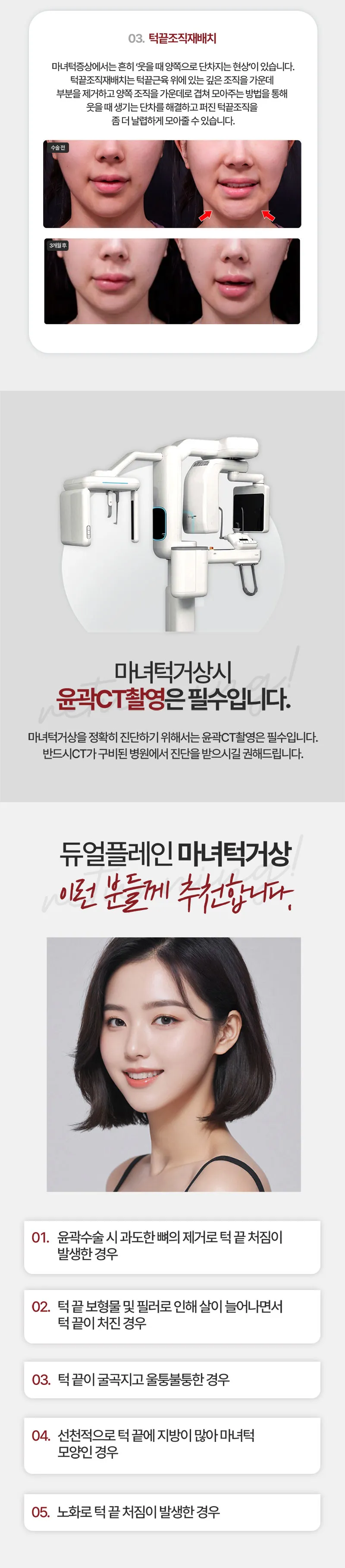 리터닝성형외과  리터닝 마녀턱거상 이벤트, 시술 상세 이미지