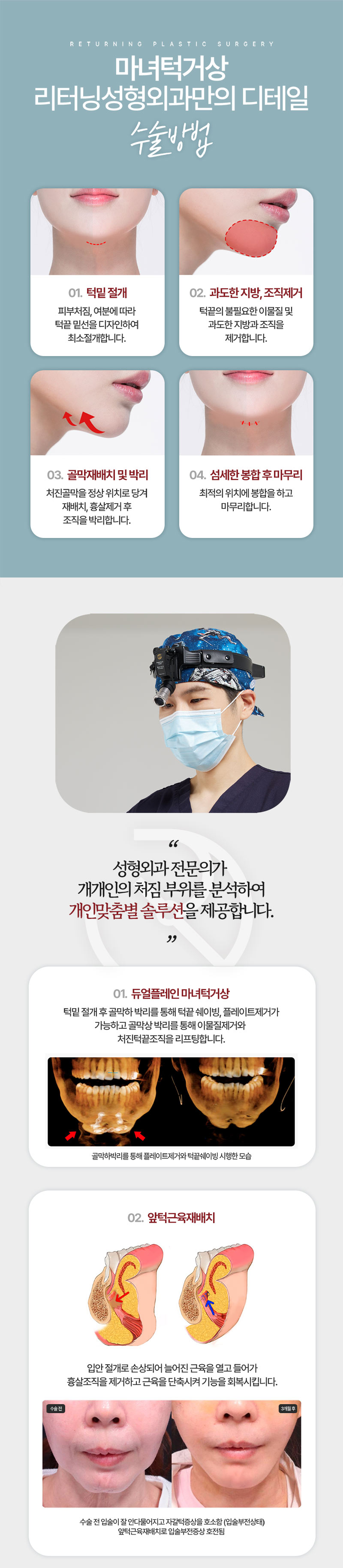 리터닝성형외과 리터닝 마녀턱거상 이벤트, 시술 상세 이미지
