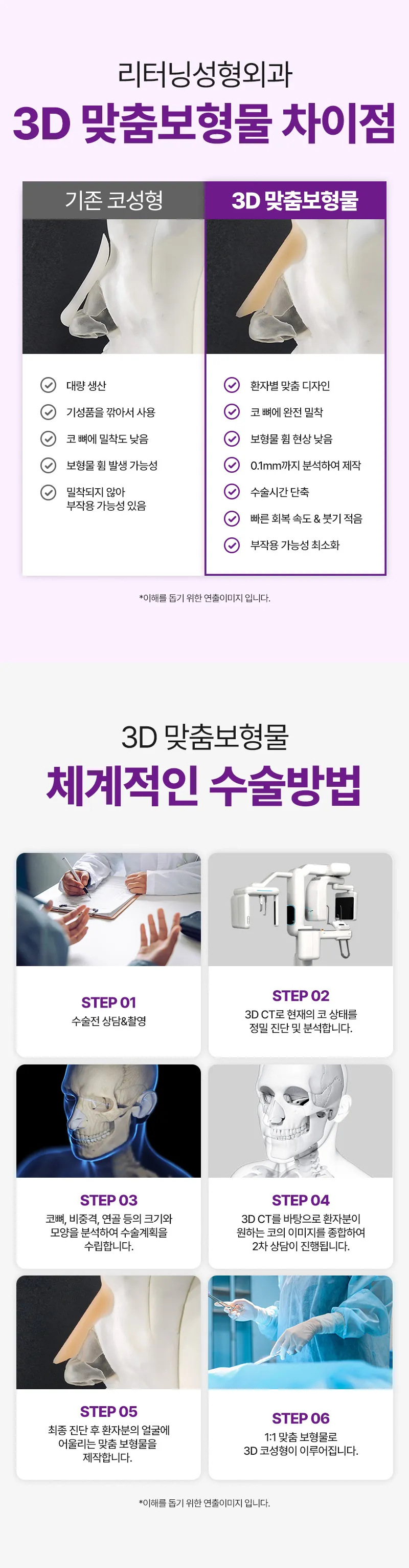 리터닝성형외과  리터닝3D핏미코맞춤보형물 이벤트, 시술 상세 이미지