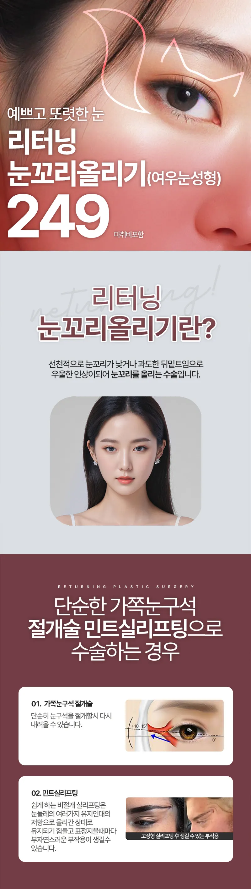 리터닝성형외과  리터닝눈꼬리올리기 여우눈 이벤트, 시술 상세 이미지
