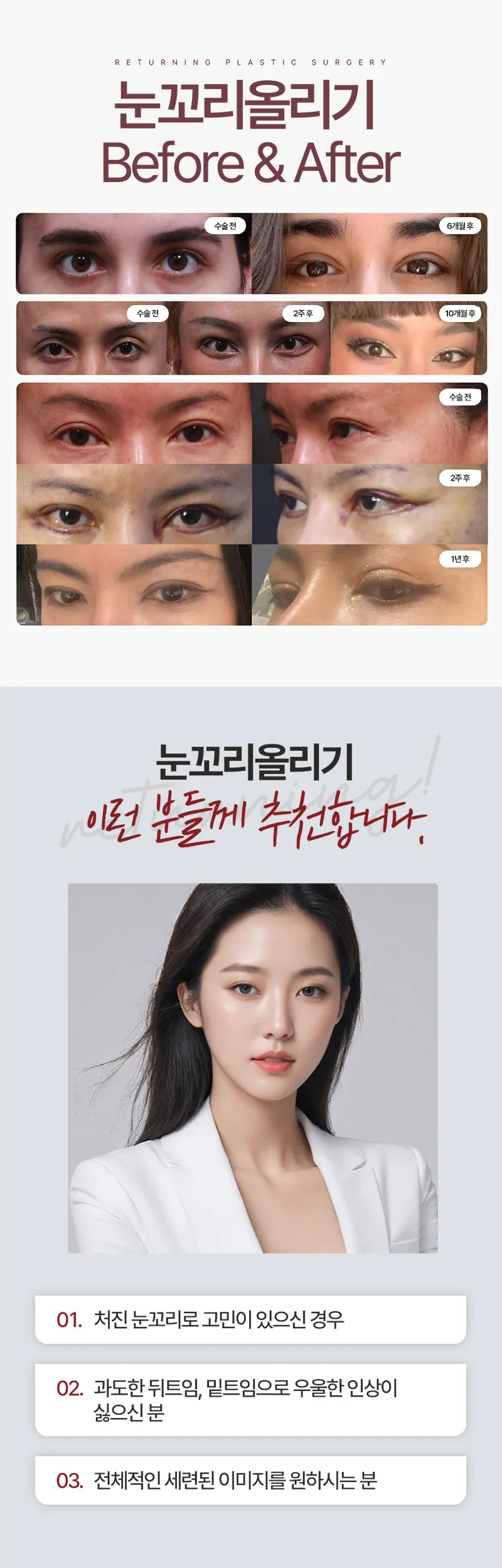 리터닝성형외과  리터닝눈꼬리올리기 여우눈 이벤트, 시술 상세 이미지