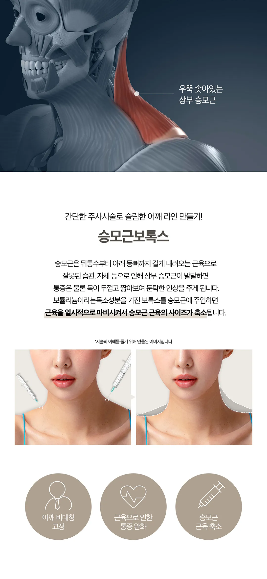 제이필의원 날씬한 종아리로 자신감 회복 이벤트, 시술 상세 이미지