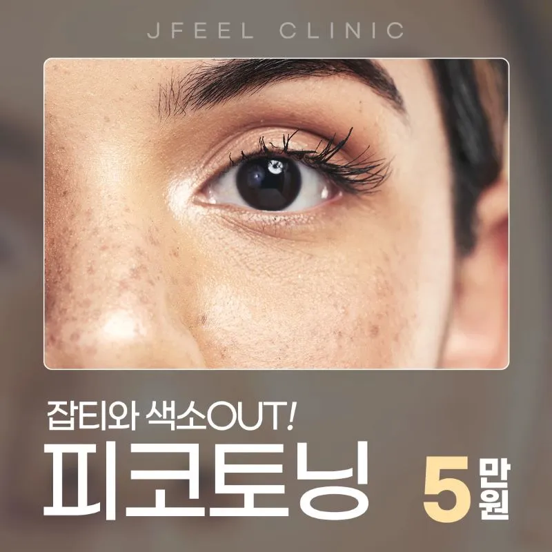 제이필의원 색소침착 치료엔 피코토닝 이벤트, 시술 상세 이미지
