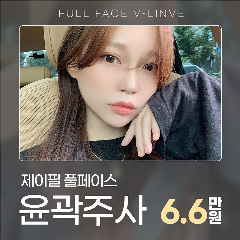 제이필의원 제이필 풀페이스 윤곽 지방분해주사 이벤트, 시술 상세 이미지