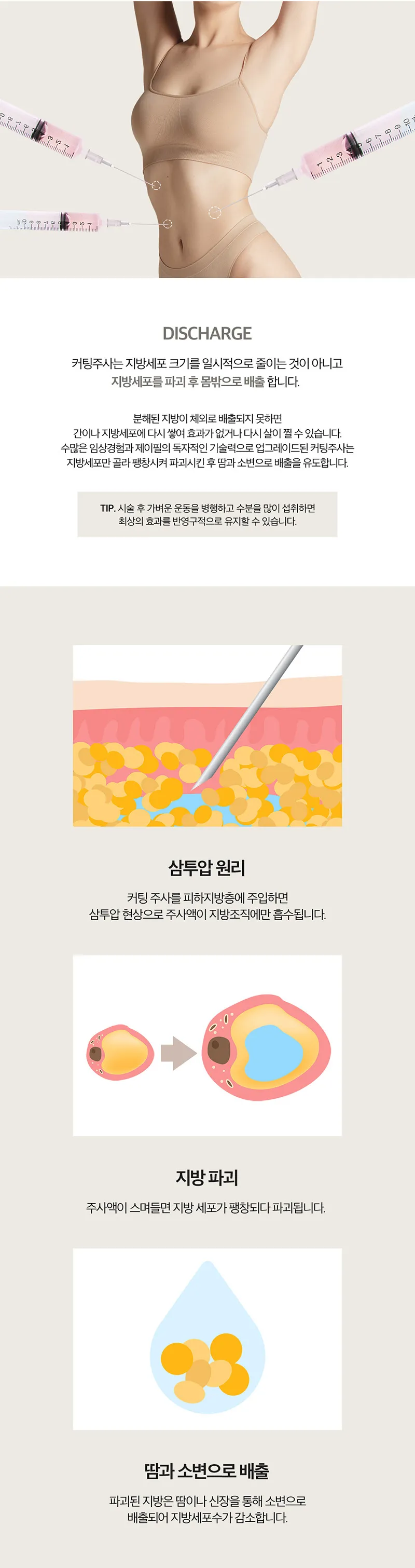 제이필의원 스테로이드 없는 강력 지방분해 커팅주 이벤트, 시술 상세 이미지