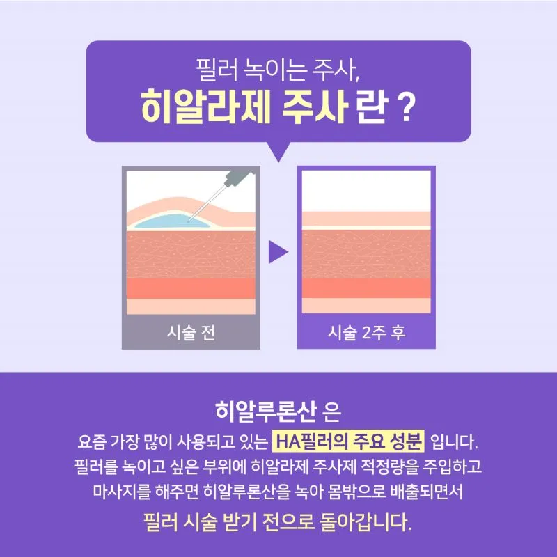 제이필의원 디테일 필러 녹이는 주사 이벤트, 시술 상세 이미지