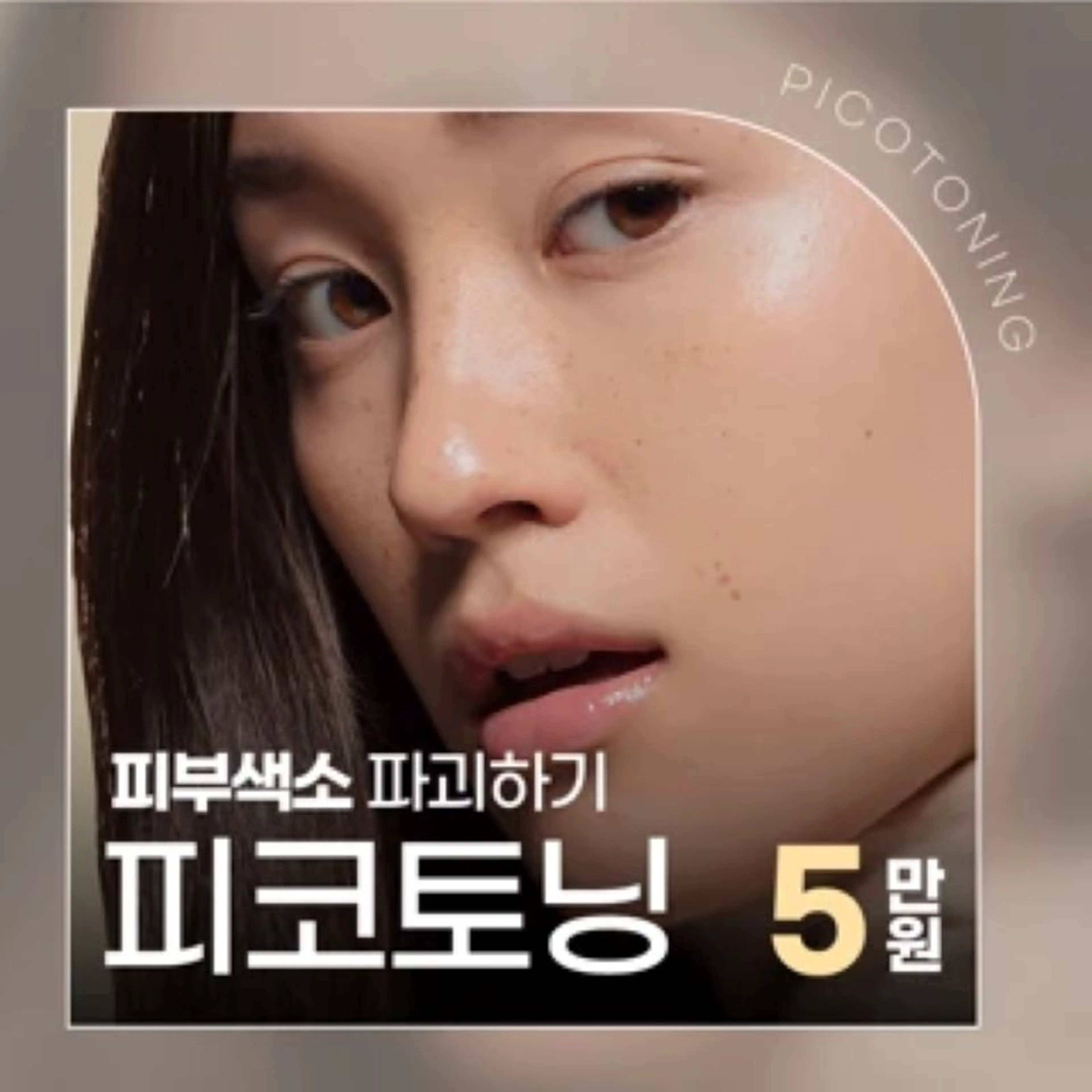 색소침착 치료엔 피코토닝