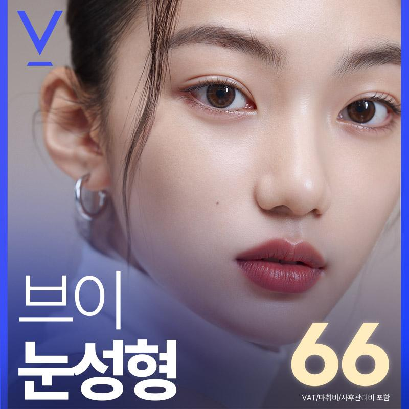 대구 브이 눈성형 이벤트 썸네일 이미지