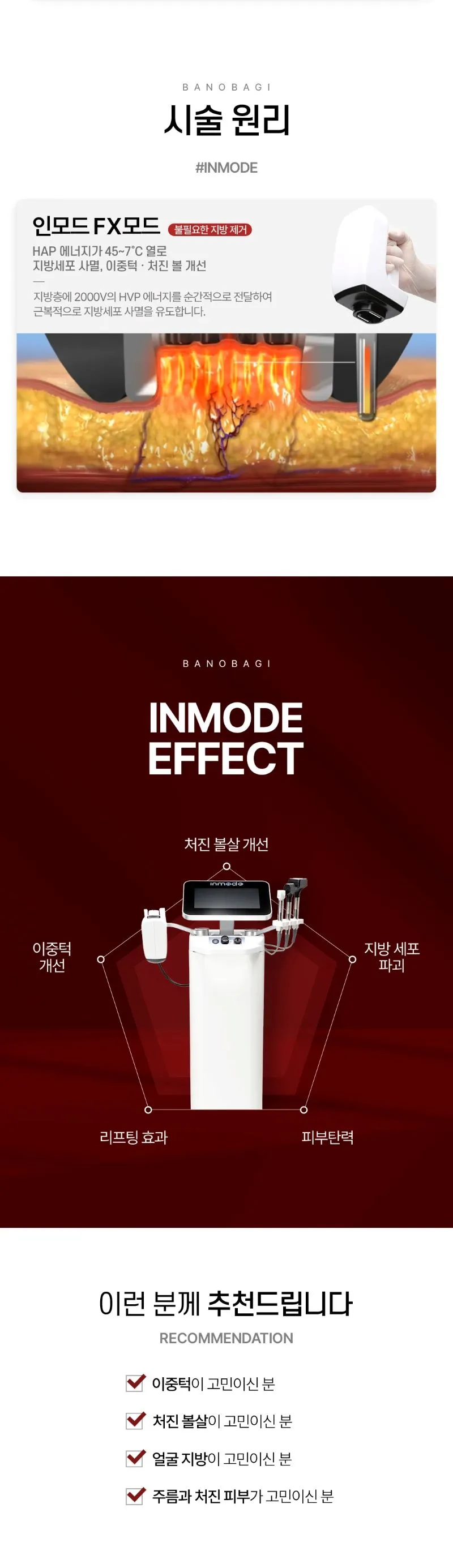 바노바기의원 부산점 인모드FX 얼굴전체 이벤트, 시술 상세 이미지