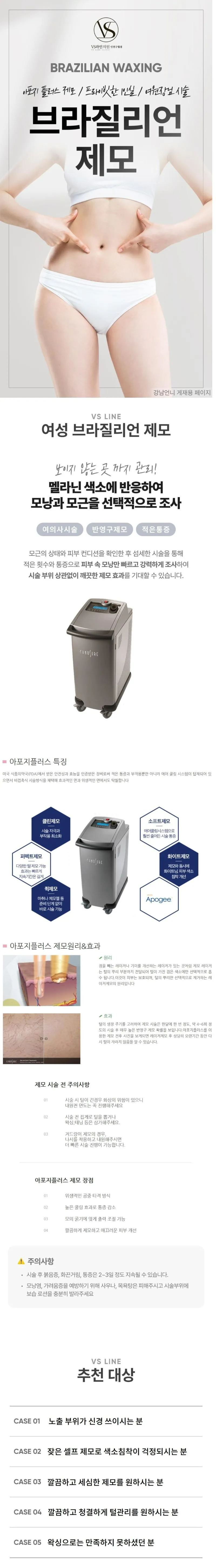 VS라인의원 인천구월점 인천 여의사_브라질리언 제모_아포지플 이벤트, 시술 상세 이미지