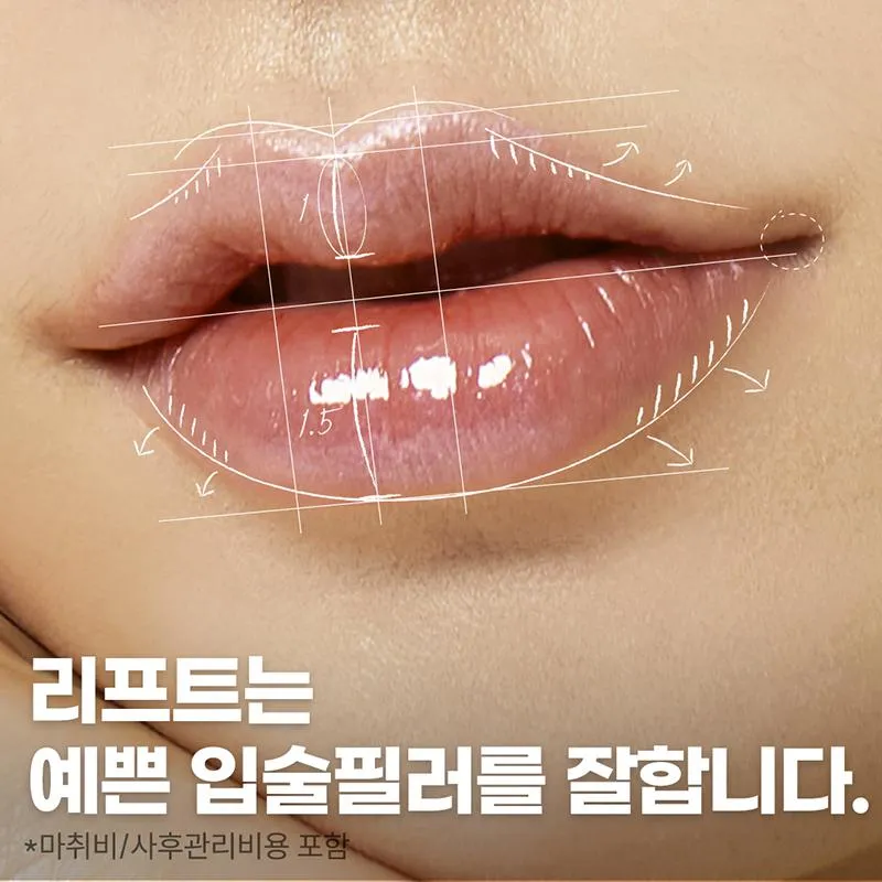대구 입술필러,입꼬리필러 이벤트 썸네일 이미지