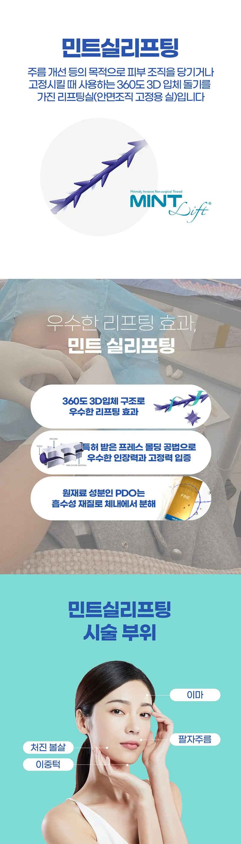 톱스타성형외과의원 광주 민트실리프팅 이벤트, 시술 상세 이미지