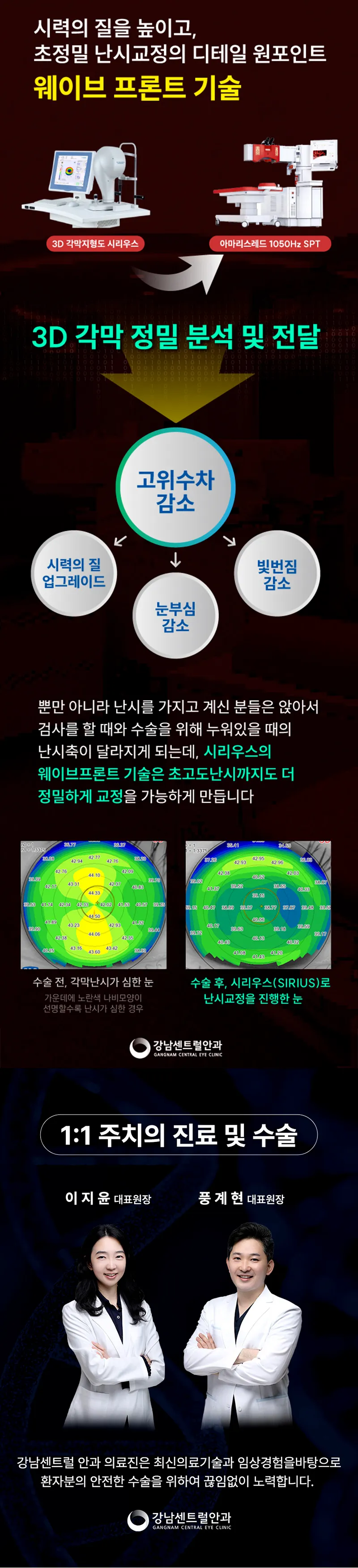 강남센트럴안과의원 수험생특가, 5세대 스마일라식, 라섹 이벤트, 시술 상세 이미지