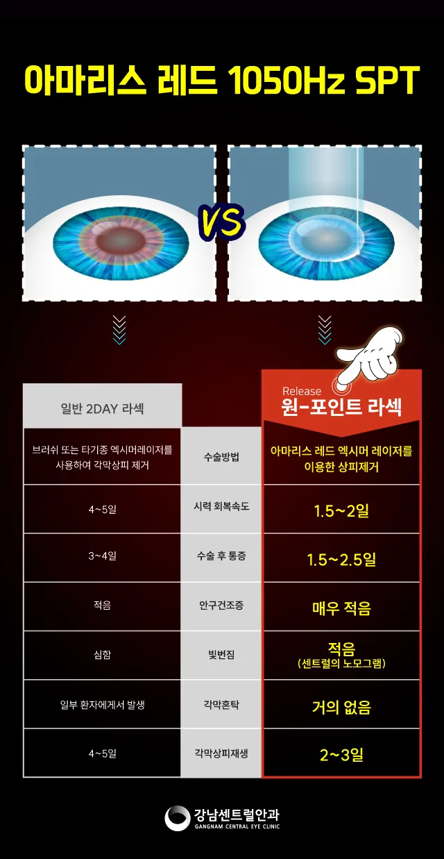 강남센트럴안과의원 단, 1.5일 회복, 원포인트 라섹 이벤트, 시술 상세 이미지