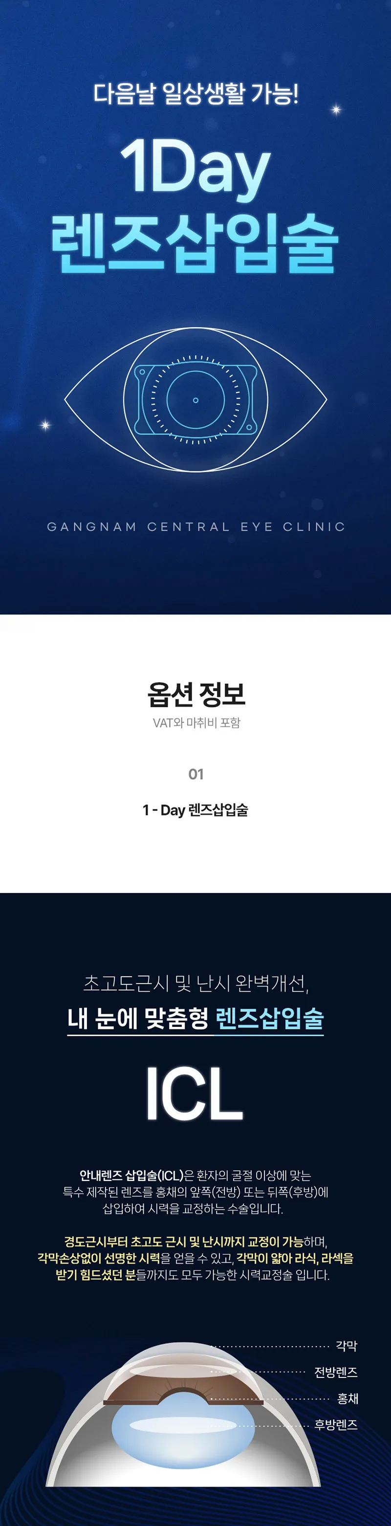 강남센트럴안과의원 개인맞춤, 1day 렌즈삽입술 이벤트, 시술 상세 이미지