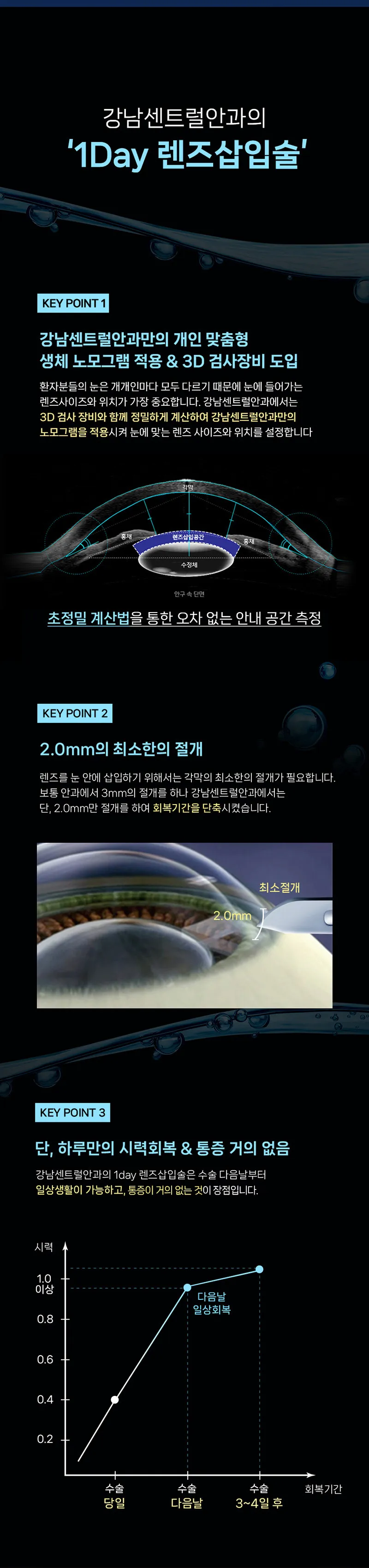 강남센트럴안과의원 개인맞춤, 1day 렌즈삽입술 이벤트, 시술 상세 이미지