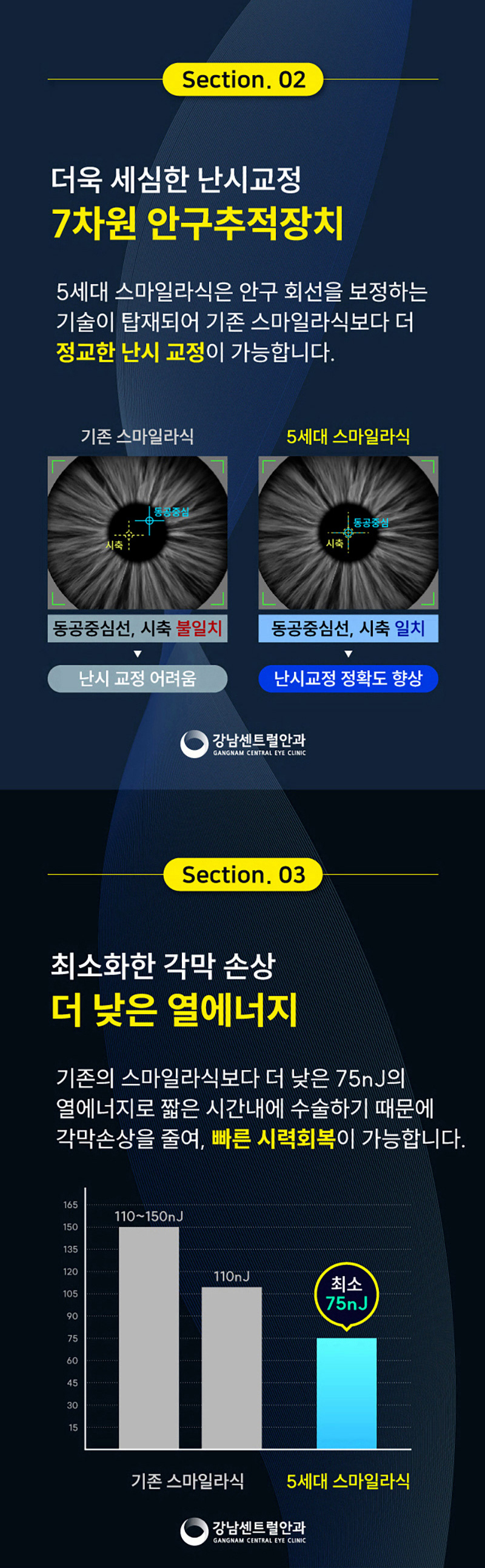 강남센트럴안과의원 추석특가, 5세대 스마일라식, 라섹 이벤트, 시술 상세 이미지