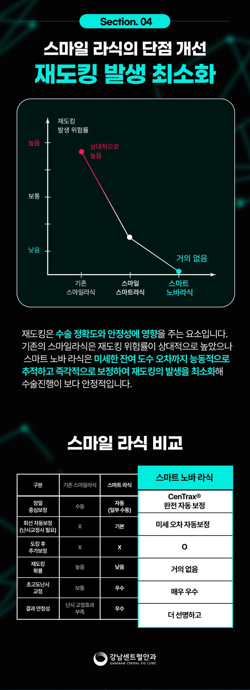 강남센트럴안과의원 특별가, 5세대 스마일라식, 라섹 이벤트, 시술 상세 이미지