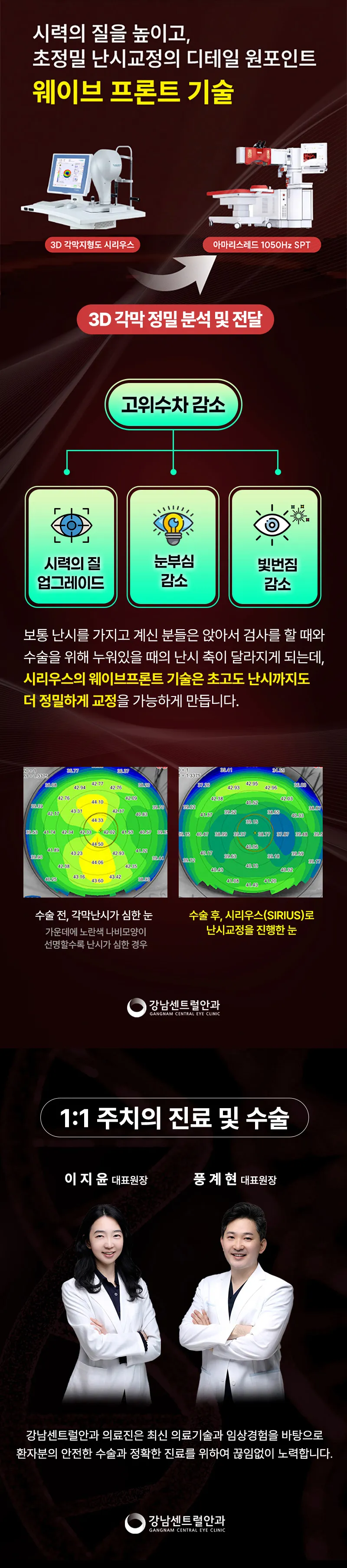 강남센트럴안과의원 특별가, 5세대 스마일라식, 라섹 이벤트, 시술 상세 이미지