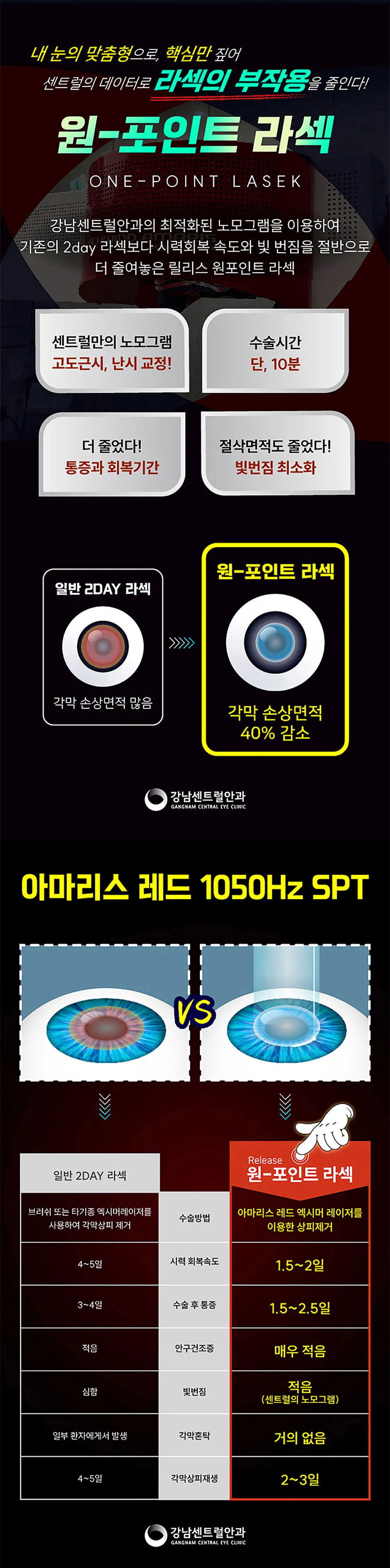 강남센트럴안과의원 특별가, 5세대 스마일라식, 라섹 이벤트, 시술 상세 이미지
