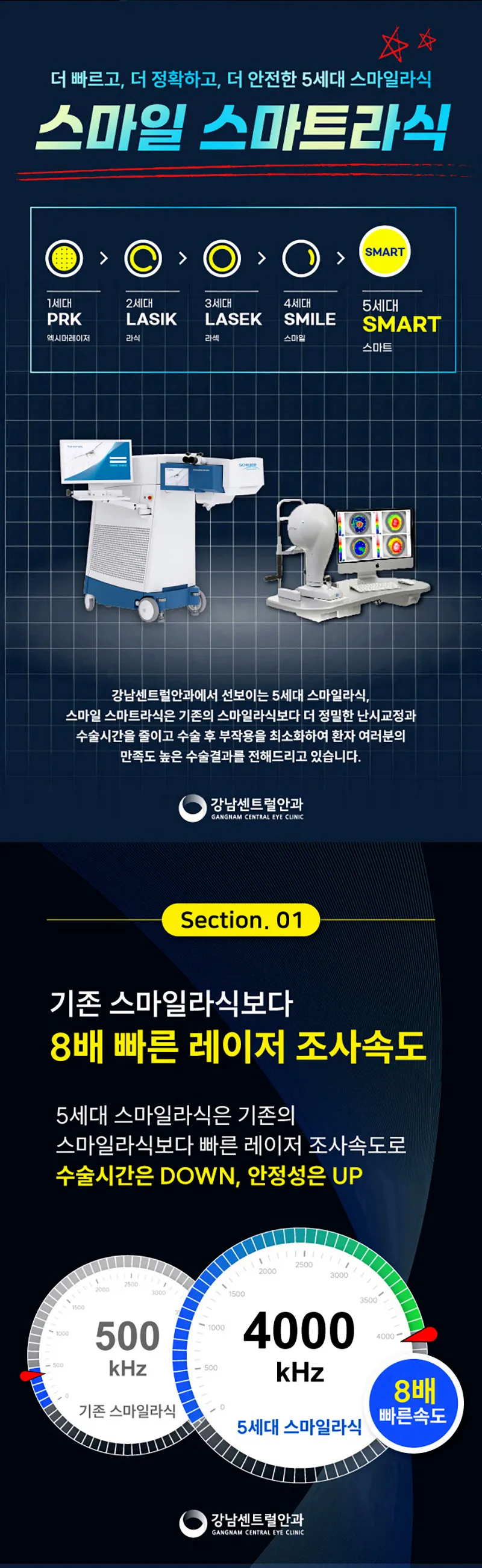 강남센트럴안과의원 수험생특가, 5세대 스마일라식, 라섹 이벤트, 시술 상세 이미지