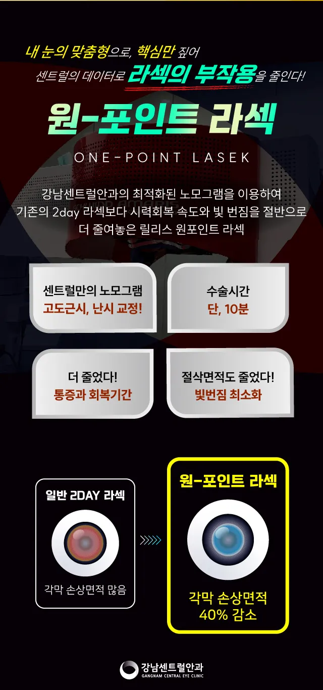 강남센트럴안과의원 단, 1.5일 회복, 원포인트 라섹 이벤트, 시술 상세 이미지