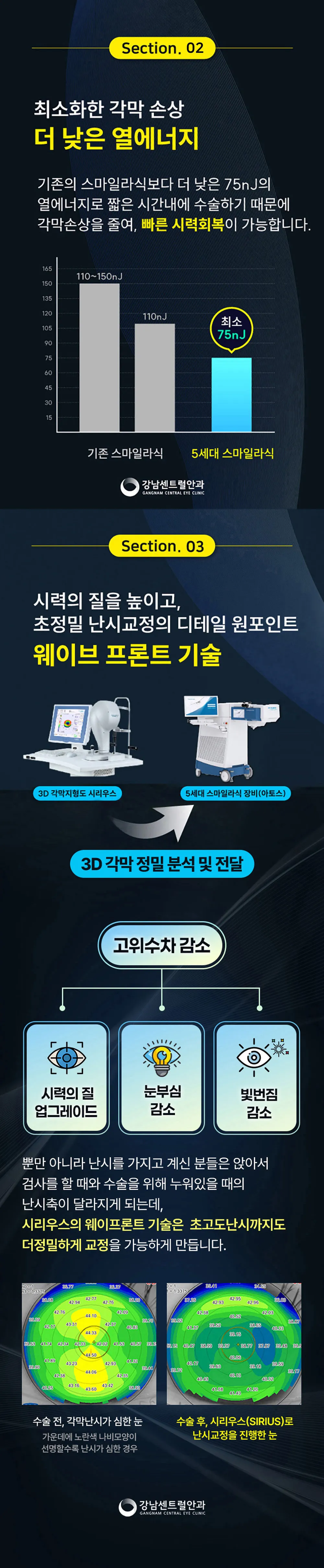 강남센트럴안과의원 특별가, 5세대 스마일라식, 라섹 이벤트, 시술 상세 이미지