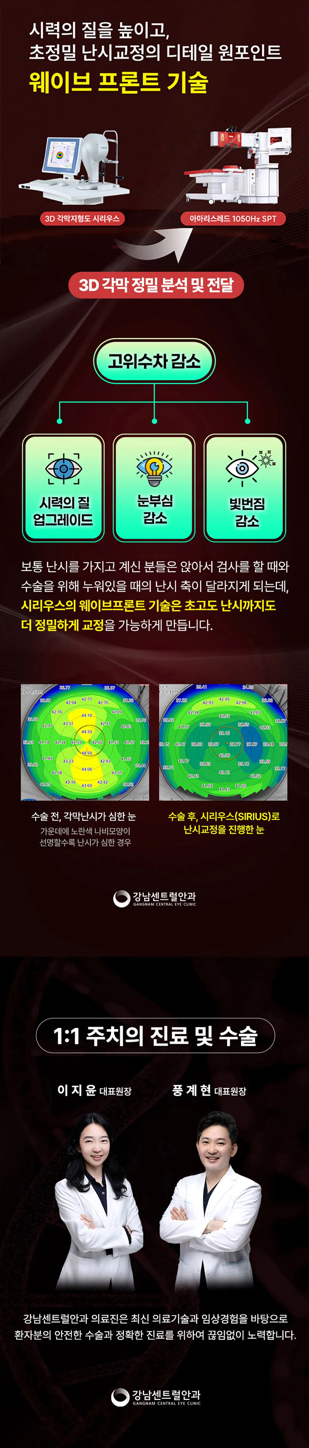 강남센트럴안과의원 특별가, 5세대 스마일라식, 라섹 이벤트, 시술 상세 이미지