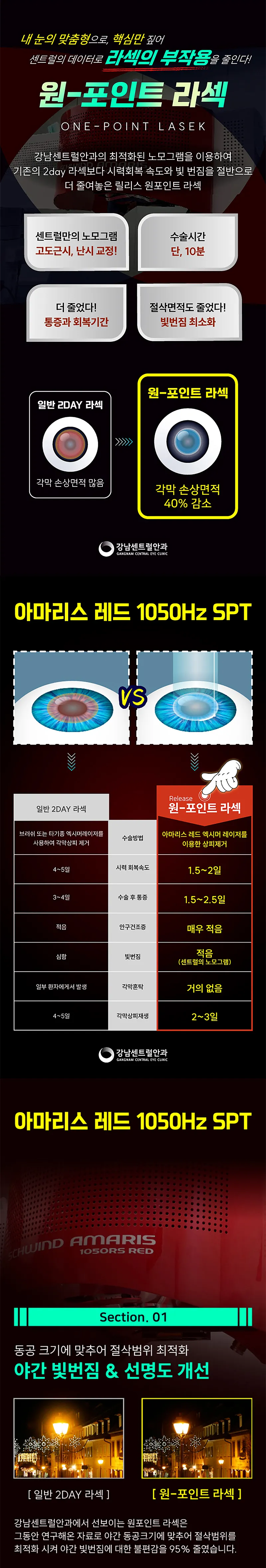 강남센트럴안과의원 단, 1.5일 회복, 원포인트 라섹 이벤트, 시술 상세 이미지