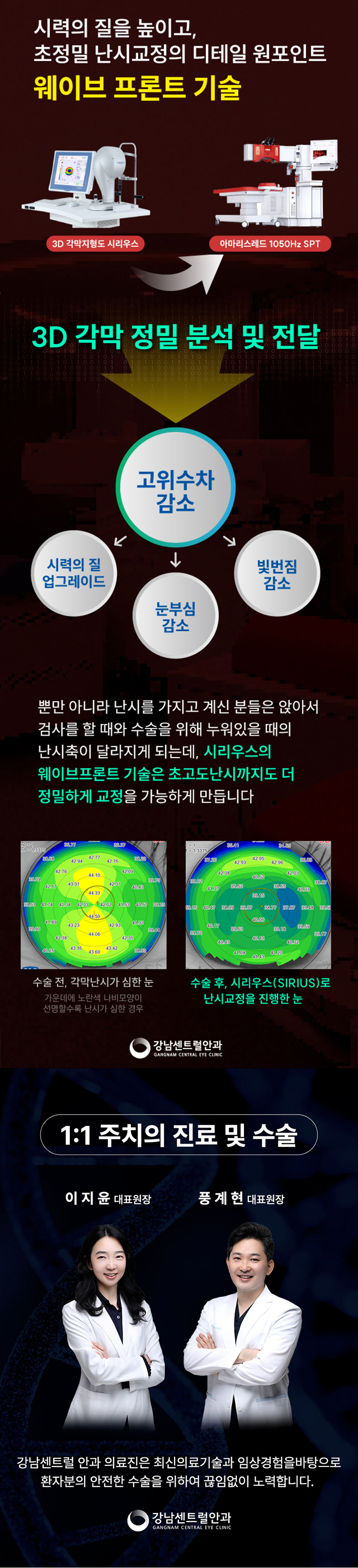 강남센트럴안과의원 특별가, 5세대 스마일라식, 라섹 이벤트, 시술 상세 이미지