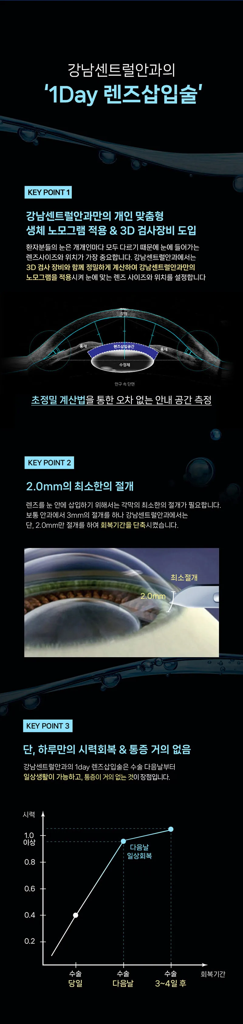 개인맞춤, 1day 렌즈삽입술