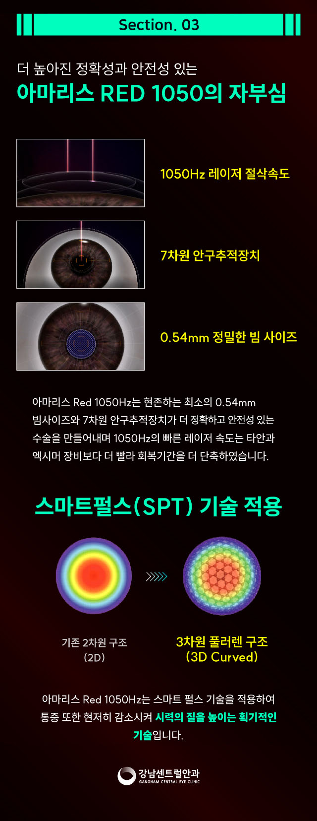 강남센트럴안과의원 단, 1.5일 회복, 원포인트 라섹 이벤트, 시술 상세 이미지
