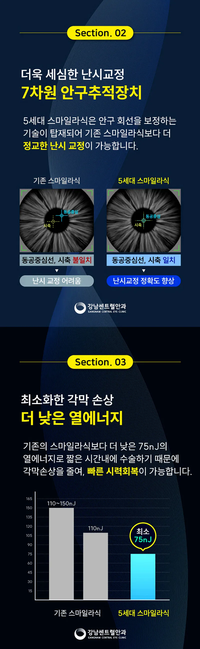 강남센트럴안과의원 수험생특가, 5세대 스마일라식, 라섹 이벤트, 시술 상세 이미지