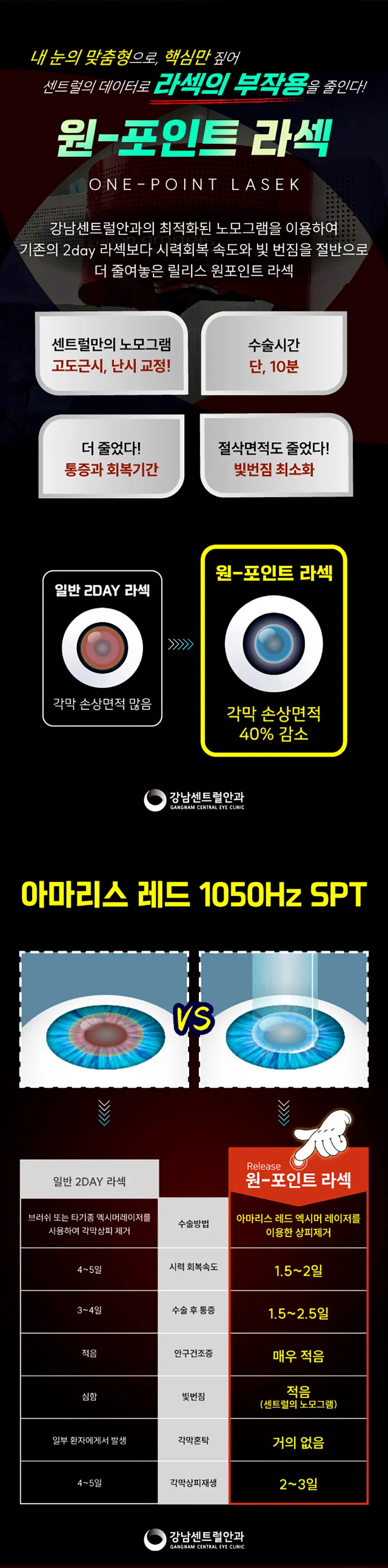 강남센트럴안과의원 수험생특가, 5세대 스마일라식, 라섹 이벤트, 시술 상세 이미지