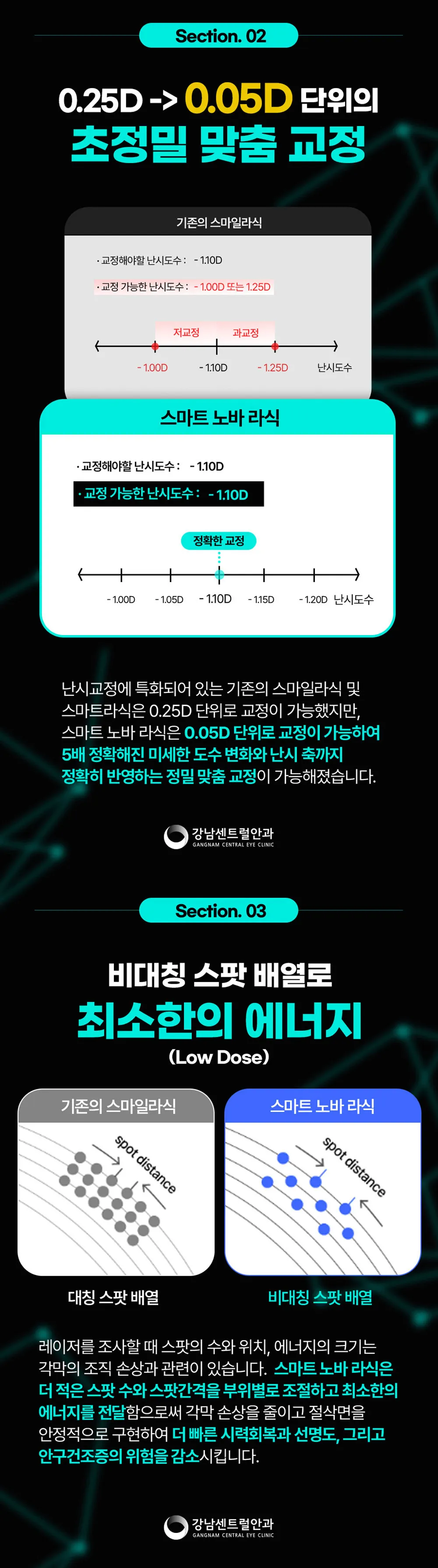 강남센트럴안과의원 특별가, 5세대 스마일라식, 라섹 이벤트, 시술 상세 이미지