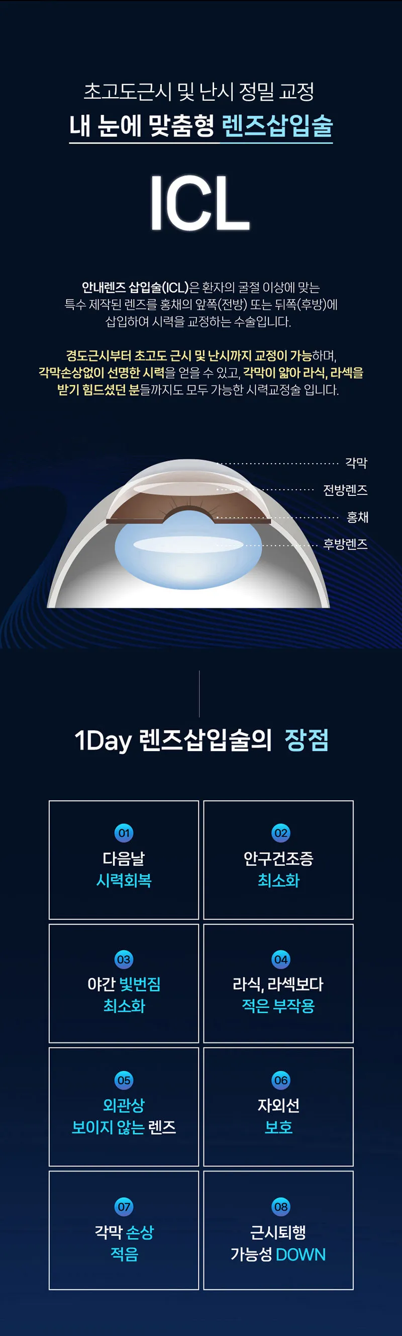 강남센트럴안과의원 개인맞춤, 1day 렌즈삽입술 이벤트, 시술 상세 이미지