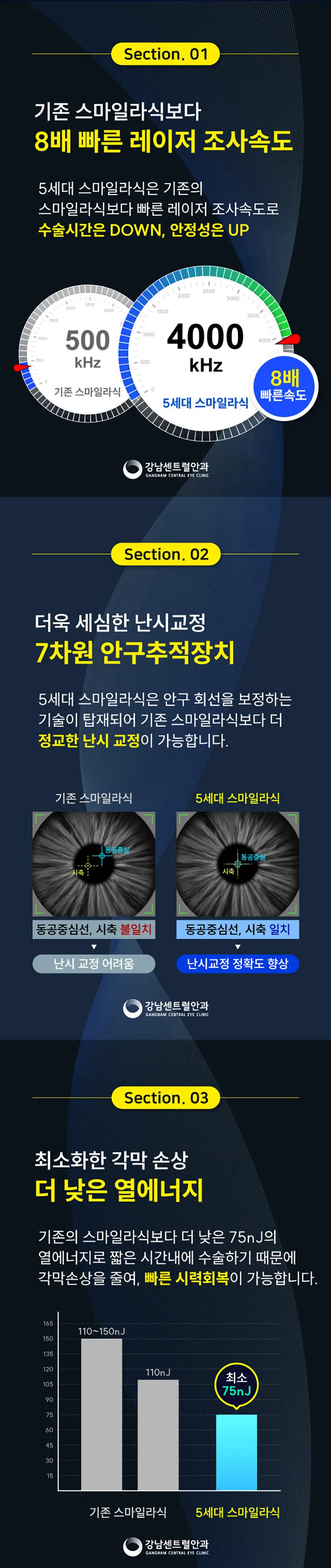 강남센트럴안과의원 개인 맞춤형 5세대 스마트 스마일라식 이벤트, 시술 상세 이미지