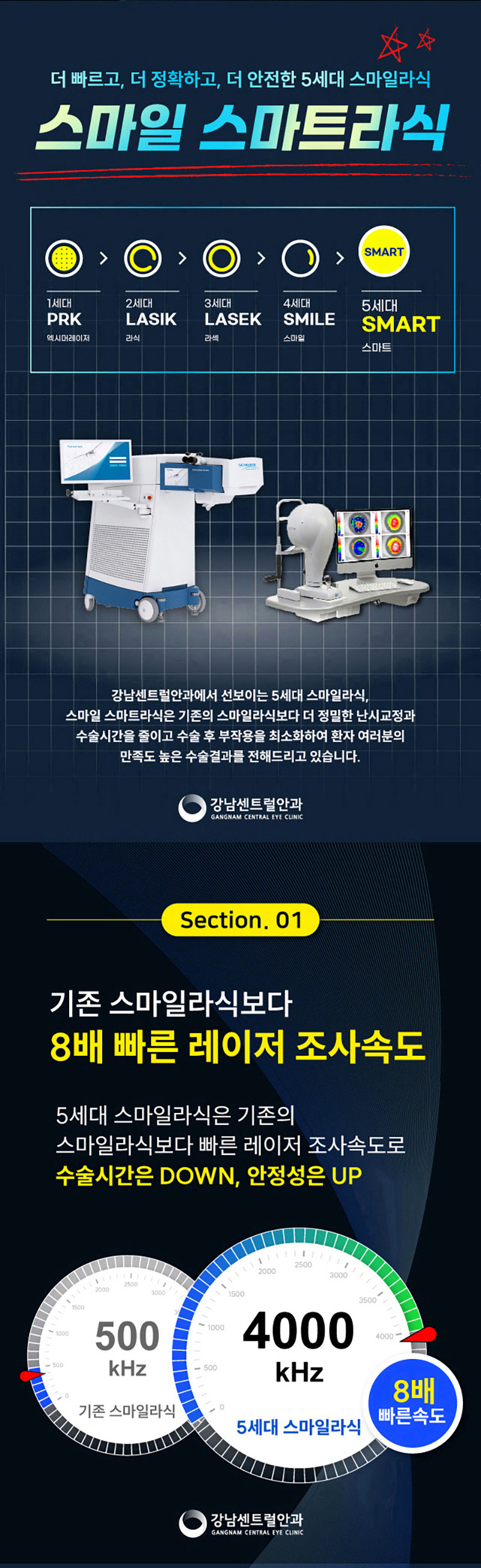 강남센트럴안과의원 추석특가, 5세대 스마일라식, 라섹 이벤트, 시술 상세 이미지