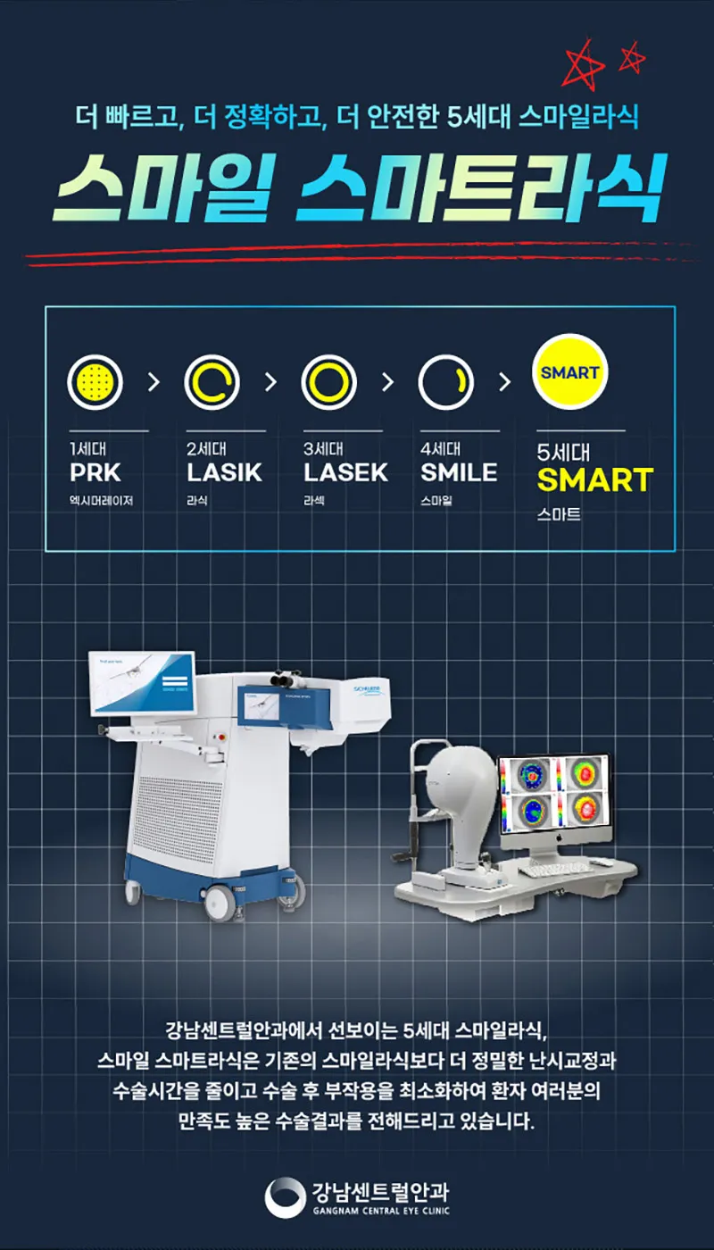 강남센트럴안과의원 개인 맞춤형 5세대 스마트 스마일라식 이벤트, 시술 상세 이미지