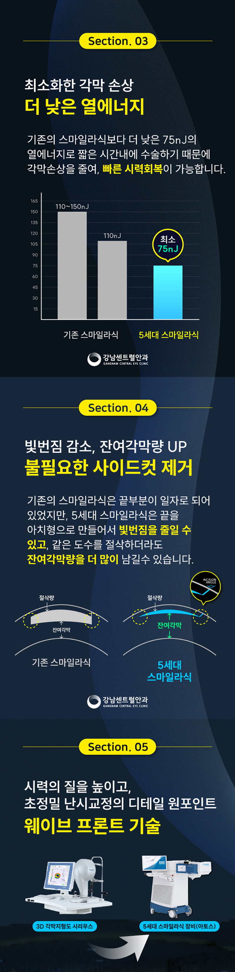 강남센트럴안과의원 개인 맞춤형 5세대 스마트 스마일라식 이벤트, 시술 상세 이미지
