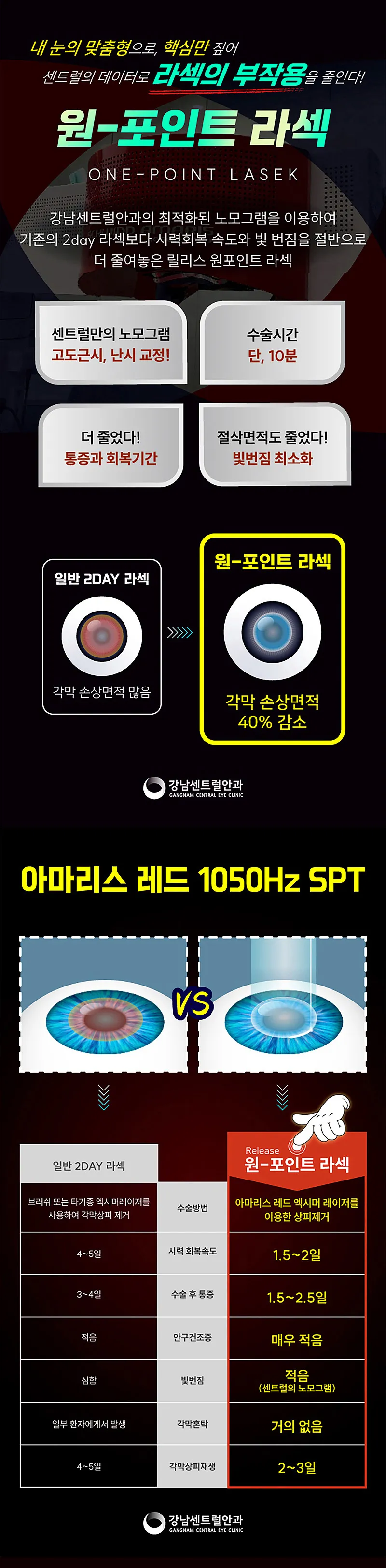 강남센트럴안과의원 특별가, 5세대 스마일라식, 라섹 이벤트, 시술 상세 이미지