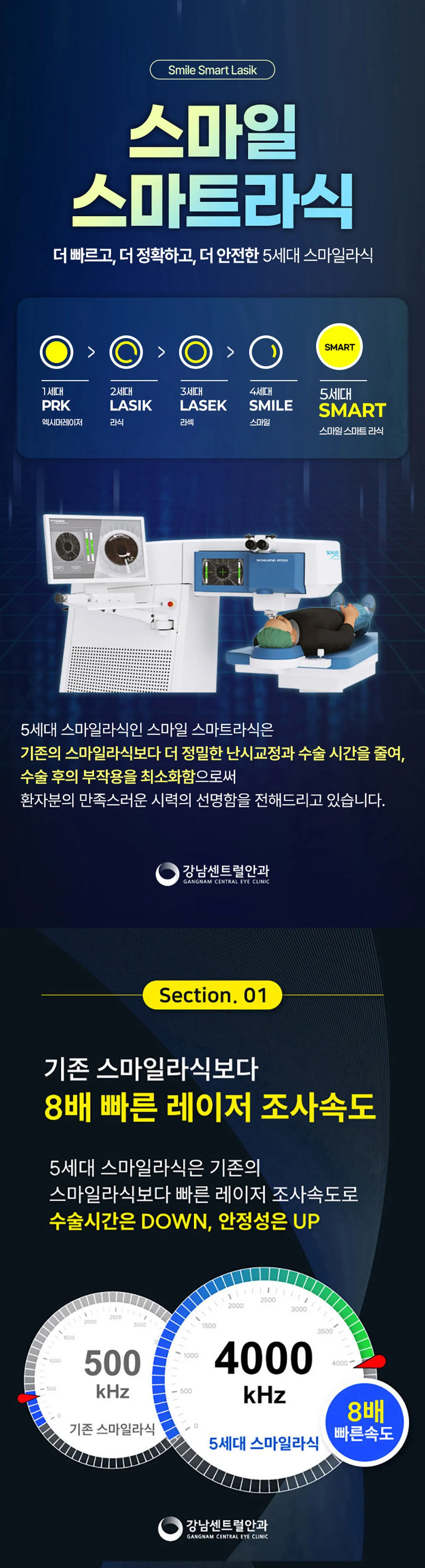 강남센트럴안과의원 특별가, 5세대 스마일라식, 라섹 이벤트, 시술 상세 이미지