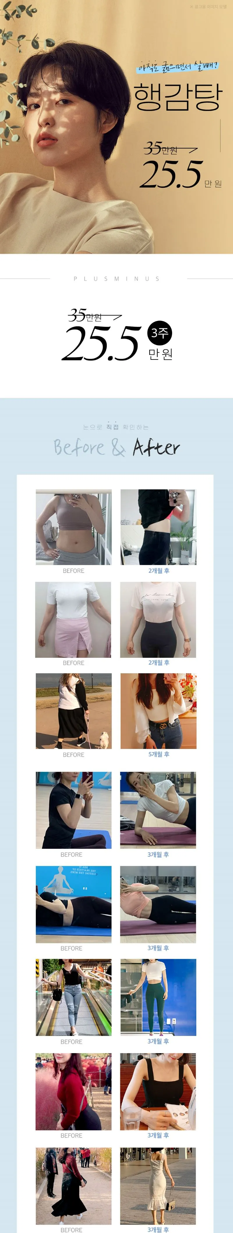 플러스마이너스한의원 비만체질개선 행감탕 다이어트 이벤트, 시술 상세 이미지